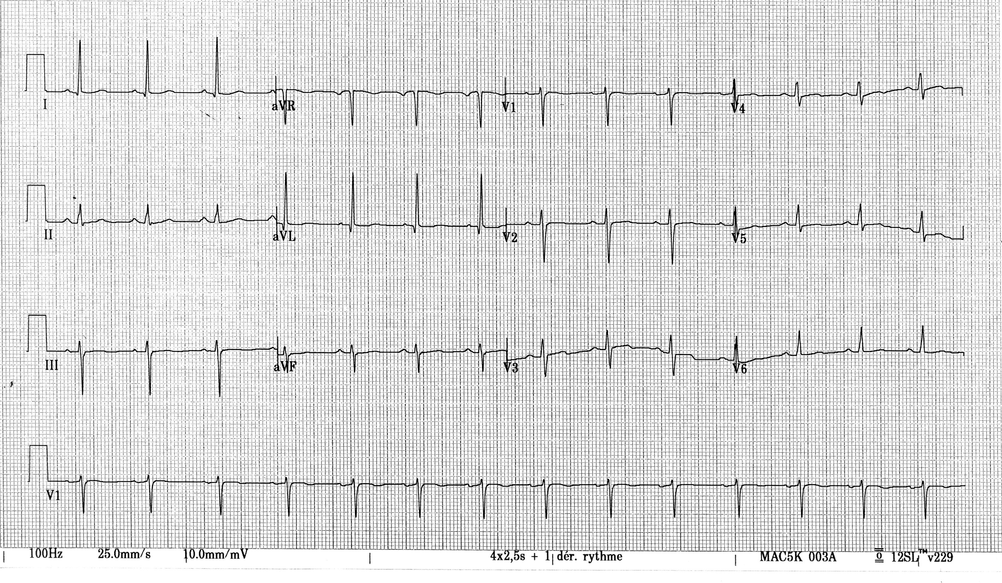 ECG-5155